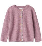 Name It Cardigan - Strik - NbfRikimmi - Mauve Orchid